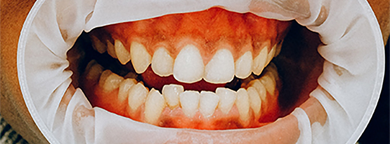 complex dental problems