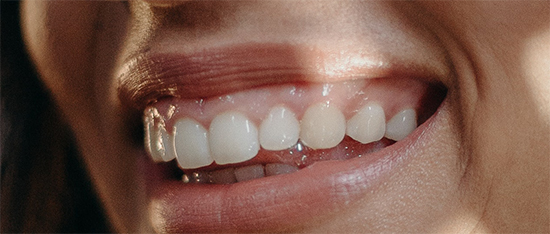 white bright teeth